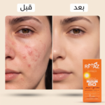 Rimaz Sunscreen Collection 60-70 g