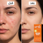 Rimaz Sunscreen Collection 60-70 g